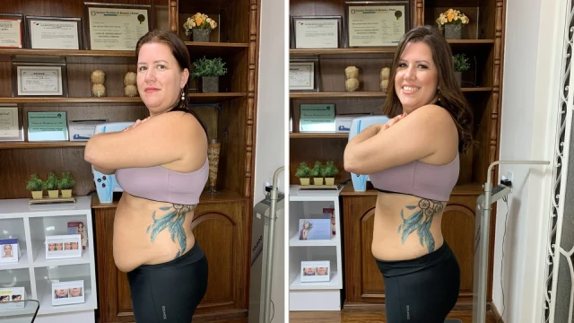 Antes e Depois da Amanda